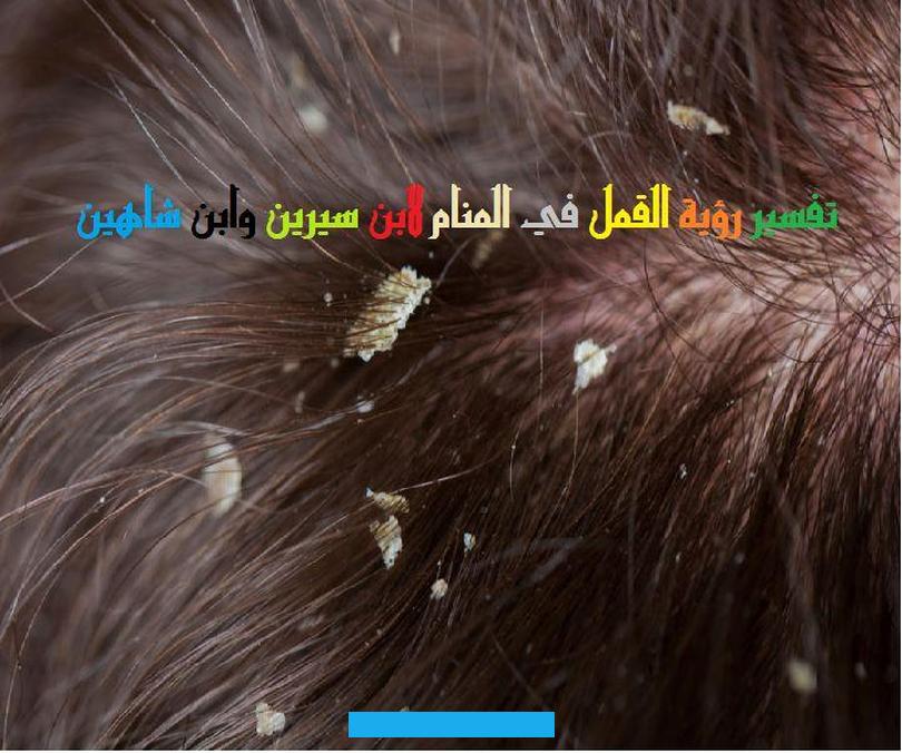 الصعوبات.بينما الفتاة المخطوبة التي ترى في منامها أنها تمشط شعرها ويسقط القمل منه في المنام وكان لونه أسود وكبير الحجم. فهي دلالة على الحسد والعداوة من أشخاص مقربين.تفسير حلم تمشيط الشعر وسقوط القمل لابن سيرينيفسر ابن سيرين رؤية تمشيط الشعر. وسقوط القمل في المنام بأنها تشير إلى قدوم السعادة والأخبار السارة.من يرى في منامه أنه يمشط شعره ويسقط القمل منه فهي.