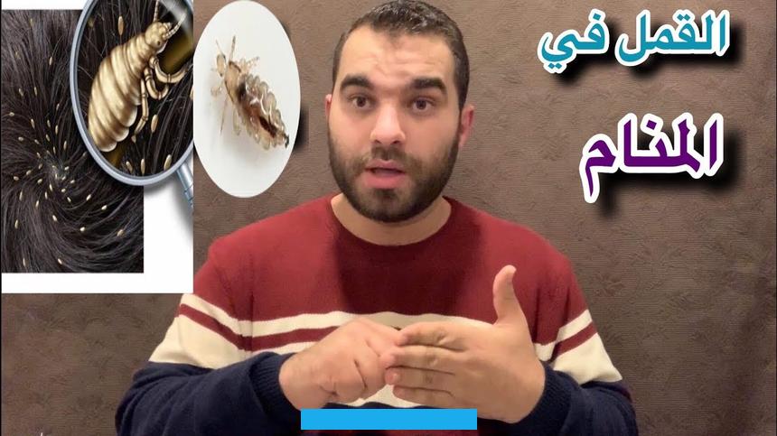 ونصائحها.تفسير حلم القمل في الشعر للحاملعند رؤية المرأة الحامل للقمل في شعرها خلال المنام. فإن ذلك يعكس وجود أشخاص يحملون لها مشاعر الغيرة والحسد. ويسعون لإلحاق الضرر بسمعتها من خلال نشر الأكاذيب.إذا وجدت نفسها تزيل القمل من شعرها.