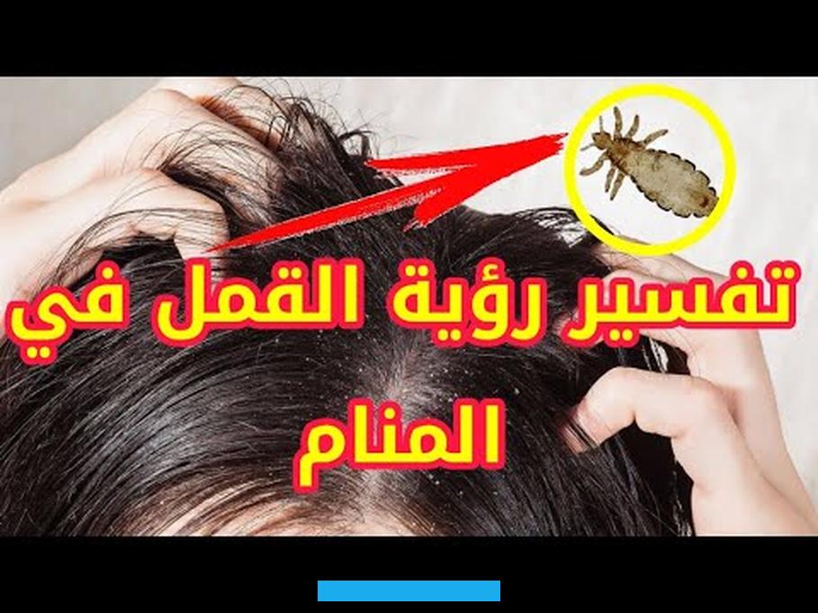 رؤية القمل الأسود في الشعر للمرأة المتزوجة.فيدل على القمل في رأسها في المنام.فيدل على أنها امرأة مدبرة لشئون بيتها وأنها. تستغل الفرص لإسعاد بيتها وتلبي كل طلباته والله تعالى أعلى وأعلم.أما إذا رأت المرأة المتزوجة أنها تقوم بتصفيف شعر بنتها. ويخرج من شعرها قمل كثير وهي تنزعج كثيرا لهذا الأمر.فيدل على أن هذه البنت الصغيرة سوف تفرح قلب أمها وأبيها بالتفوق.
